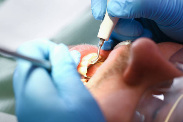 Best Emergency Gum Treatment in Oakland, MO