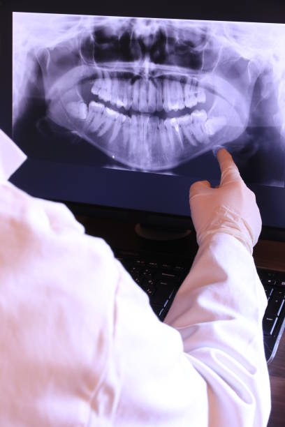 Best Emergency Treatment for Dental Infections or Abscesses in Oakland, MO
